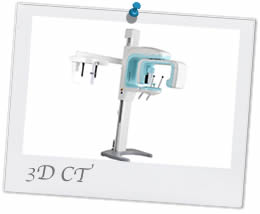 3次元CT 3DCT|おおもり矯正歯科クリニック設備紹介